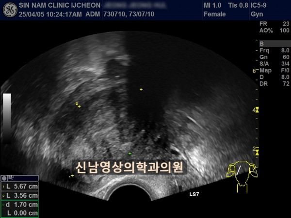 2ad35bb8fdde78a88fb8c45a7739a700_1757044